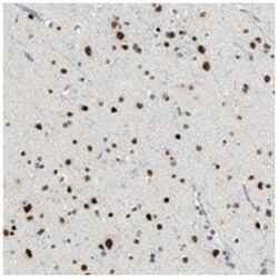 SF4, Rabbit, Polyclonal Antibody, Abnova 100&mu;L; Unlabeled:Antibodies,