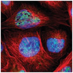 SF4, Rabbit, Polyclonal Antibody, Abnova 100&mu;L; Unlabeled:Antibodies,