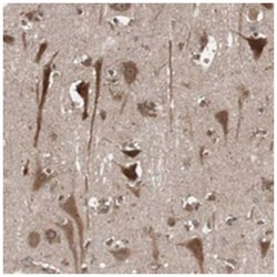 SEC31A, Rabbit, Polyclonal Antibody, Abnova 100 &mu;L | Buy Online | Abnova Corporation | Fisher Scientific