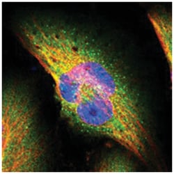 SEC31A, Rabbit, Polyclonal Antibody, Abnova 100 &mu;L | Buy Online | Abnova Corporation | Fisher Scientific