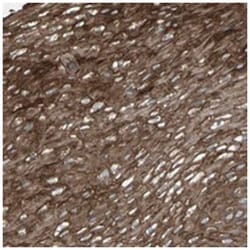 LANCL3, Rabbit, Polyclonal Antibody, Abnova 100 &mu;L | Buy Online | Abnova Corporation | Fisher Scientific