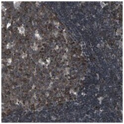 SH2B3, Rabbit, Polyclonal Antibody, Abnova 100 &mu;L | Buy Online | Abnova Corporation | Fisher Scientific