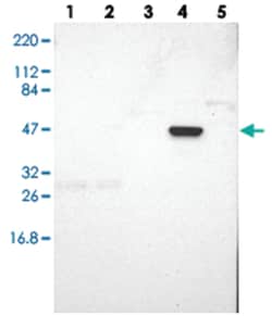 ZNF701, Rabbit, Polyclonal Antibody, Abnova 100&mu;L; Unlabeled:Antibodies,