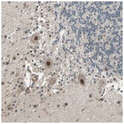 ZNF701, Rabbit, Polyclonal Antibody, Abnova 100&mu;L; Unlabeled:Antibodies,