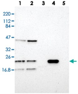 LDOC1L Rabbit anti-Human, Polyclonal Antibody, Abnova 100&mu;L; Unlabeled:Antibodies,