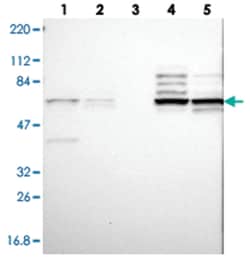 CNOT4 Rabbit anti-Human, Polyclonal Antibody, Abnova 100&mu;L; Unlabeled:Antibodies,