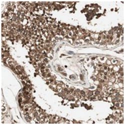 CNOT4 Rabbit anti-Human, Polyclonal Antibody, Abnova 100&mu;L; Unlabeled:Antibodies,