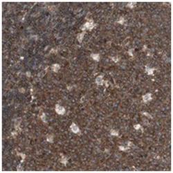 TCP11L1, Rabbit, Polyclonal Antibody, Abnova 100 &mu;L | Buy Online | Abnova Corporation | Fisher Scientific