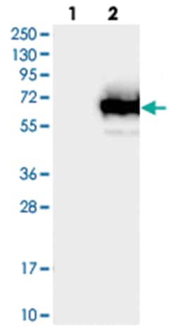 TCP11L1, Rabbit, Polyclonal Antibody, Abnova 100 &mu;L | Buy Online | Abnova Corporation | Fisher Scientific