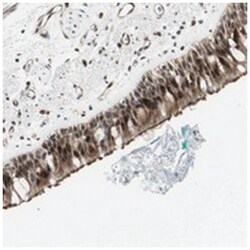 ZBTB17, Rabbit, Polyclonal Antibody, Abnova 100&mu;L; Unlabeled:Antibodies,