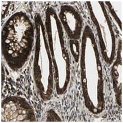 MYOM2 Rabbit anti-Human, Polyclonal Antibody, Abnova 100 &mu;L | Buy Online | Abnova Corporation | Fisher Scientific