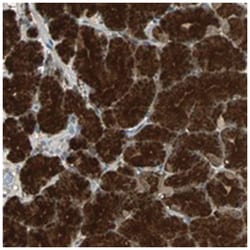 ABHD2, Rabbit, Polyclonal Antibody, Abnova 100 &mu;L | Buy Online | Abnova | Fisher Scientific