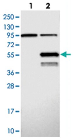 ABHD2, Rabbit, Polyclonal Antibody, Abnova 100 &mu;L | Buy Online | Abnova | Fisher Scientific