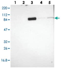MTIF2, Rabbit, Polyclonal Antibody, Abnova 100 &mu;L | Buy Online | Abnova Corporation | Fisher Scientific