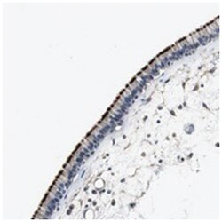 MTIF2, Rabbit, Polyclonal Antibody, Abnova 100 &mu;L | Buy Online | Abnova Corporation | Fisher Scientific