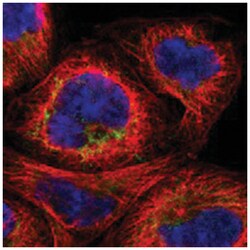 MTIF2, Rabbit, Polyclonal Antibody, Abnova 100 &mu;L | Buy Online | Abnova Corporation | Fisher Scientific