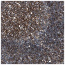SCIMP, Rabbit, Polyclonal Antibody, Abnova 100 &mu;L | Buy Online | Abnova Corporation | Fisher Scientific