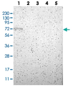 RBM47, Rabbit, Polyclonal Antibody, Abnova 100 &mu;L | Buy Online | Abnova Corporation | Fisher Scientific