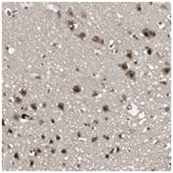EMX1, Rabbit, Polyclonal Antibody, Abnova 100 &mu;L | Buy Online | Abnova | Fisher Scientific