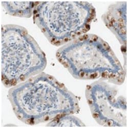 ITLN2, Rabbit, Polyclonal Antibody, Abnova 100&mu;L; Unlabeled:Antibodies,