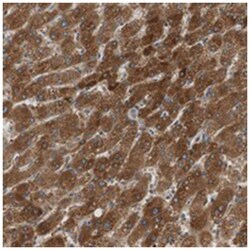 FADS2, Rabbit, Polyclonal Antibody, Abnova 100 &mu;L | Buy Online | Abnova Corporation | Fisher Scientific