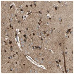 GPR114, Rabbit, Polyclonal Antibody, Abnova 100 &mu;L | Buy Online | Abnova | Fisher Scientific