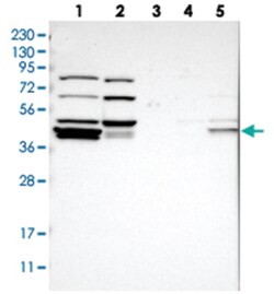RDBP, Rabbit, Polyclonal Antibody, Abnova 100 &mu;L | Buy Online | Abnova Corporation | Fisher Scientific
