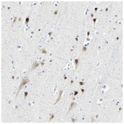 RDBP, Rabbit, Polyclonal Antibody, Abnova 100 &mu;L | Buy Online | Abnova Corporation | Fisher Scientific