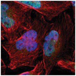 RDBP, Rabbit, Polyclonal Antibody, Abnova 100 &mu;L | Buy Online | Abnova Corporation | Fisher Scientific