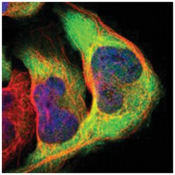 CYTIP, Rabbit, Polyclonal Antibody, Abnova 100 &mu;L | Buy Online | Abnova | Fisher Scientific