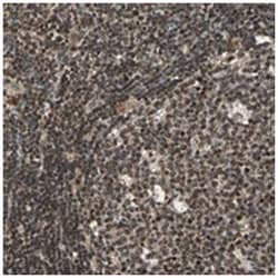 SCAND3, Rabbit, Polyclonal Antibody, Abnova 100&mu;L; Unlabeled:Antibodies,