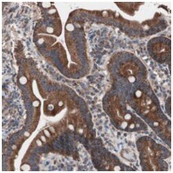 CTTNBP2NL, Rabbit, Polyclonal Antibody, Abnova 100 &mu;L | Buy Online | Abnova | Fisher Scientific