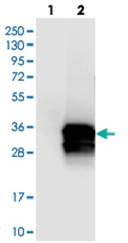 CALB2 Rabbit anti-Human, Polyclonal Antibody, Abnova 100&mu;L; Unlabeled:Antibodies,