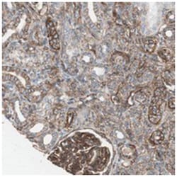 TCTA, Rabbit, Polyclonal Antibody, Abnova 100&mu;L; Unlabeled:Antibodies,