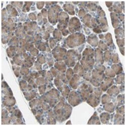 C6orf162, Rabbit, Polyclonal Antibody, Abnova 100 &mu;L | Buy Online | Abnova Corporation | Fisher Scientific