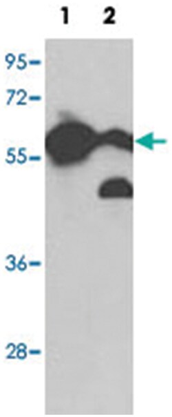 PKM2 Rabbit anti-Human, Mouse, Polyclonal Antibody, Abnova 400&mu;L; Unlabeled:Antibodies,