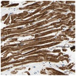 OTOF Rabbit anti-Human, Polyclonal Antibody, Abnova 100&mu;L; Unlabeled:Antibodies,