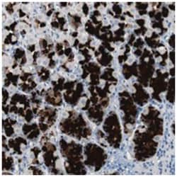 ULBP1 Rabbit anti-Human, Polyclonal Antibody, Abnova 100&mu;L; Unlabeled:Antibodies,