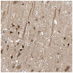 HECW1 Rabbit anti-Human, Polyclonal Antibody, Abnova 100 &mu;L | Buy Online | Abnova | Fisher Scientific