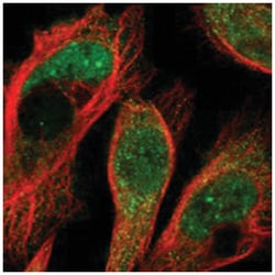 HECW1 Rabbit anti-Human, Polyclonal Antibody, Abnova 100 &mu;L | Buy Online | Abnova | Fisher Scientific