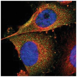 FER Rabbit anti-Human, Polyclonal Antibody, Abnova 100 &mu;L | Buy Online | Abnova Corporation | Fisher Scientific
