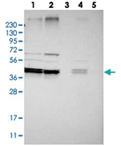 AUP1, Rabbit, Polyclonal Antibody, Abnova 100&mu;L; Unlabeled:Antibodies,