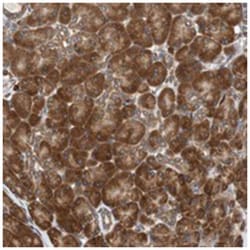 AUP1, Rabbit, Polyclonal Antibody, Abnova 100&mu;L; Unlabeled:Antibodies,