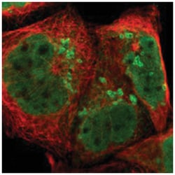 AUP1, Rabbit, Polyclonal Antibody, Abnova 100&mu;L; Unlabeled:Antibodies,