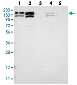 CCAR1, Rabbit, Polyclonal Antibody, Abnova 100&mu;L; Unlabeled:Antibodies,