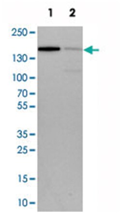 CCAR1, Rabbit, Polyclonal Antibody, Abnova 100&mu;L; Unlabeled:Antibodies,