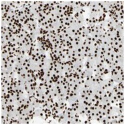 CCAR1, Rabbit, Polyclonal Antibody, Abnova 100&mu;L; Unlabeled:Antibodies,