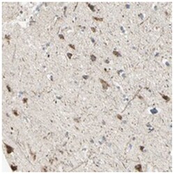 ABCA3, Rabbit, Polyclonal Antibody, Abnova 100 &mu;L | Buy Online | Abnova Corporation | Fisher Scientific