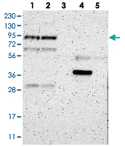 LEPREL1 Rabbit anti-Human, Rat, Polyclonal Antibody, Abnova 100 &mu;L | Buy Online | Abnova Corporation | Fisher Scientific