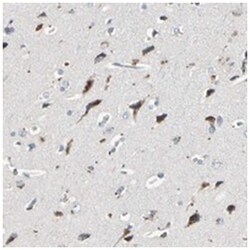 IL1RL1 Rabbit anti-Human, Polyclonal Antibody, Abnova 100&mu;L; Unlabeled:Antibodies,